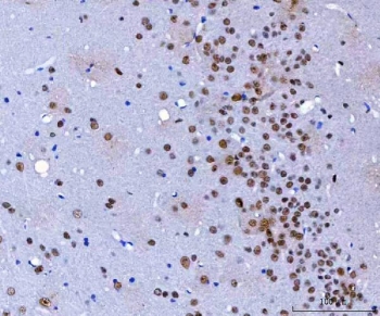 IHC staining of FFPE mouse brain tissue with hnRNP H antibody. HIER: boil tissue sections in pH8 EDTA for 20 min and allow to cool before testing.