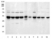Western blot testing of 1) human 293T, 2) human HeLa, 3) human HepG2, 4) human MCF7, 5) human LNCaP, 6) human U-2 OS, 7) human RT4, 8) rat C6, 9) rat PC-12 and 10) mouse NIH 3T3 cell lysate with hnRNP H antibody. Predicted molecular weight ~49 kDa.