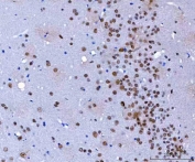 IHC staining of FFPE mouse brain tissue with hnRNP H antibody. HIER: boil tissue sections in pH8 EDTA for 20 min and allow to cool before testing.