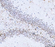 IHC staining of FFPE rat brain tissue with hnRNP H antibody. HIER: boil tissue sections in pH8 EDTA for 20 min and allow to cool before testing.