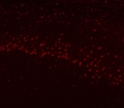 Immunofluorescent staining of FFPE rat brain tissue with hnRNP H antibody (red). HIER: steam section in pH8 EDTA buffer for 20 min.