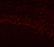 Immunofluorescent staining of FFPE rat brain tissue with hnRNP H antibody (red). HIER: steam section in pH8 EDTA buffer for 20 min.