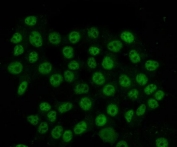 Immunofluorescent staining of FFPE human MCF7 cells with hnRNP H antibody (green). HIER: steam section in pH6 citrate buffer for 20 min.