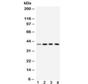 Western blot testing of 1) rat liver, 2) mouse kidney, 3) human HeLa and 4) human HePG2 lysate with VASP antibody at 0.5ug/ml. Expected molecular weight:  ~40/46-50 kDa (unmodified/phosphorylated).