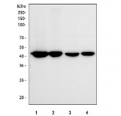 IHC testing of FFPE human breast cancer tissue with VASP antibody at 1ug/ml. HIER: steam section in pH6 citrate buffer for 20 min.