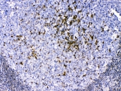 IHC testing of FFPE human tonsil tissue with CCS antibody a 1ug/ml. Required HIER: steam section in pH6 citrate buffer for 20 min and allow to cool prior to testing.