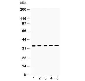 Western blot testing of 1) rat brain, 2) rat spleen, 3) mouse brain, 4) mouse spleen and 5) human 293T lysate with CCS antibody at 0.5ug/ml. Predicted molecular weight ~34 kDa.~