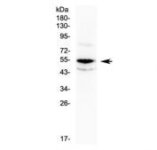 Western blot testing of human SW620 cell lysate with CHK1 antibody at 0.5ug/ml. Predicted molecular weight ~54 kDa.