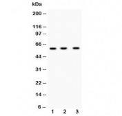 Western blot testing of 1) rat thymus, 2) mouse heart and 3) human K562 lysate with DR5 antibody at 0.5ug/ml. Predicted molecular weight ~48 kDa, often observed at ~60 kDa.