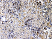 IHC testing of FFPE rat kidney tissue with DR5 antibody at 1ug/ml. Required HIER: steam section in pH6 citrate buffer for 20 min and allow to cool prior to testing.