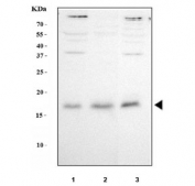 Western blot testing of human 1) HeLa, 2) Jurkat and 3) 293T cell lysate with Survivin antibody. Predicted molecular weight ~16 kDa.