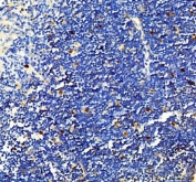 IHC staining of FFPE mouse thymus tissue with Survivin antibody. HIER: boil tissue sections in pH8 EDTA for 20 min and allow to cool before testing.