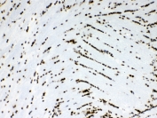 IHC testing of FFPE rat brain tissue with Musashi antibody at 1ug/ml. Required HIER: steam section in pH6 citrate buffer for 20 min and allow to cool prior to testing.