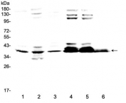 Western blot testing of 1) rat brain, 2) rat testis, 3) mouse brain, 4) human 293T, 5) human 293T and 6) human HepG2 lysate with Musashi antibody at 0.5ug/ml. Predicted molecular weight ~39 kDa.