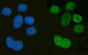 Immunofluorescent staining of FFPE human MCF7 cells with Musashi antibody (green) and DAPI nuclear stain (blue). HIER: steam section in pH6 citrate buffer for 20 min.