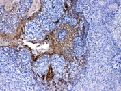 IHC testing of FFEP human tonsil tissue with Periplakin antibody at 1ug/ml. Required HIER: steam section in pH6 citrate buffer for 20 min and allow to cool prior to testing.