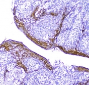 IHC testing of FFEP human tonsil tissue with Periplakin antibody. Required HIER: steam section in pH8 EDTA for 20 min and allow to cool prior to testing.