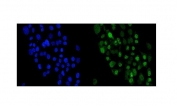 Immunofluorescent staining of FFPE human A431 cells with Periplakin antibody (green) and DAPI nuclear stain (blue). HIER: steam section in pH6 citrate buffer for 20 min.