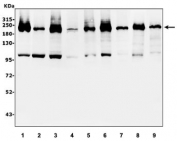 Western blot testing of human 1) HeLa, 2) A549, 3) SW620, 4) HepG2, 5) SK-O-V3, 6) PANC-1, 7) SGC-7801, 8) rat lung and 9) mouse lung lysate with Periplakin antibody at 0.5ug/ml. Predicted molecular weight ~205 kDa.