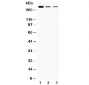 Western blot testing of 1) rat testis, 2) mouse Hepa1-6 and 3) human HepG2 lysate with TECTA antibody at 0.5ug/ml. Predicted molecular weight: ~240 kDa.