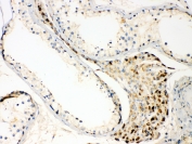 IHC testing of FFPE human testis tissue with TECTA antibody at 1ug/ml. Required HIER: steam section in pH6 citrate buffer for 20 min and allow to cool prior to testing.
