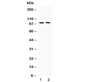 Western blot testing of 1) rat lung and 2) human PANC1 lysate with PDE5A antibody at 0.5ug/ml. Predicted molecular weight ~100 kDa (isoform 1).~