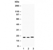 Western blot testing of 1) rat lung, 2) mouse liver and 3) human MCF7 lysate with AGR2 antibody at 0.5ug/ml. Expected molecular weight: 17-20 kDa.