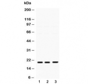 Western blot testing of 1) rat brain, 2) mouse brain and 3) human A549 lysate with HRAS antibody at 0.5ug/ml. Predicted molecular weight ~21 kDa.