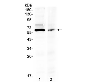 Western blot testing of human 1) 293T and 2) COLO320 lysate with AMH antibody at 0.5ug/ml. Predicted molecular weight ~60 kDa. Glycosylated homodimer may be seen at ~ 140 kDa.