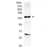 Western blot testing of human HepG2 cell lysate with HER2 antibody.  Predicted molecular weight ~138 kDa (unmodified), ~185 kDa (glycosylated).