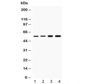 Western blot testing of 1) rat liver, 2) mouse liver, 3) human HeLa and 4) human HepG2 lysate with Cytokeratin 18 antibody at 0.5ug/ml. Predicted molecular weight ~48 kDa.