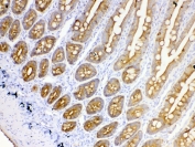 IHC testing of FFPE rat intestinal tissue with Cytokeratin 18 antibody at 1ug/ml. Required HIER: steam section in pH6 citrate buffer for 20 min and allow to cool prior to testing.