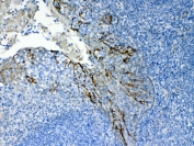 IHC testing of FFPE human tonsil tissue with Cytokeratin 8 antibody at 1ug/ml. Required HIER: steam section in pH6 citrate buffer for 20 min and allow to cool prior to testing.