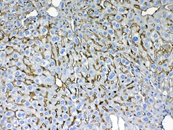 IHC testing of FFPE mouse liver tissue with Cytokeratin 8 antibody at 1ug/ml. Required HIER: steam section in pH6 citrate buffer for 20 min and allow to cool prior to testing.