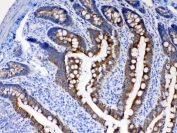 IHC testing of FFPE rat intestine tissue with Cytokeratin 8 antibody at 1ug/ml. Required HIER: steam section in pH6 citrate buffer for 20 min and allow to cool prior to testing.