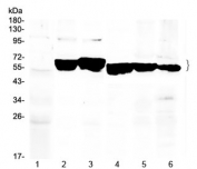 Western blot testing of 1) rat liver, 2) mouse ovay, 3) mouse liver, 4) human MCF7, 5) (h) A549 and 6) (h) HeLa lysate with Cytokeratin 8 antibody at 0.5ug/ml. Predicted molecular weight ~54 kDa.
