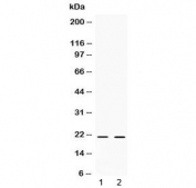 Western blot testing of 1) mouse NIH3T3 and 2) human MCF7 cell lysate with CRH antibody at 0.5ug/ml. Predicted molecular weight ~21 kDa.