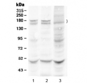 Western blot testing of 1) rat liver, 2) mouse liver and 3) human HeLa lysate with Thrombospondin antibody. Expected molecular weight ~130/155~200 kDa (unmodified/glycosylated), observed here at 165/180 kDa.