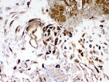 IHC testing of FFPE human placenta tissue with IGFBP1 antibody at 1ug/ml. Required HIER: steam section in pH6 citrate buffer for 20 min and allow to cool prior to testing.~