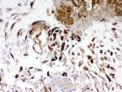 IHC testing of FFPE human placenta tissue with IGFBP1 antibody at 1ug/ml. Required HIER: steam section in pH6 citrate buffer for 20 min and allow to cool prior to testing.