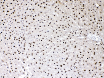 IHC testing of FFPE rat liver tissue with HMGB1 antibody at 1ug/ml. Required HIER: steam section in pH6 citrate buffer for 20 min and allow to cool prior to testing.
