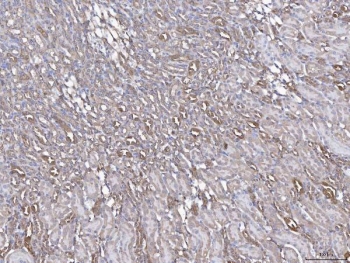 IHC staining of FFPE mouse liver tissue with Annexin IV antibody. HIER: boil tissue sections in pH8 EDTA for 20 min and allow to cool before testing.