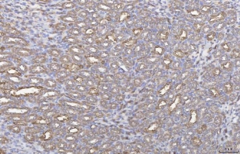 IHC staining of FFPE rat liver tissue with Annexin IV antibody. HIER: boil tissue sections in pH8 EDTA for 20 min and allow to cool before testing.