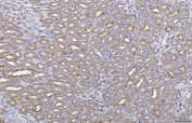 IHC staining of FFPE mouse thymus with Annexin IV antibody. HIER: boil tissue sections in pH6, 10mM citrate buffer, for 10-20 min and allow to cool before testing.