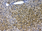 IHC testing of FFPE mouse liver tissue with CYP2D6 antibody at 1ug/ml. Required HIER: steam section in pH6 citrate buffer for 20 min and allow to cool prior to testing.