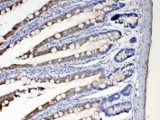 IHC testing of FFPE rat intestine tissue with CYP2D6 antibody at 1ug/ml. Required HIER: steam section in pH6 citrate buffer for 20 min and allow to cool prior to testing.