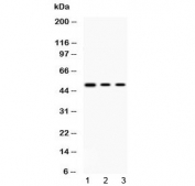Western blot testing of 1) rat thymus, 2) human HepG2 and 3) human MCF7 lysate with PRKAR1A antibody at 0.5ug/ml. Predicted molecular weight ~48 kDa.