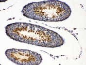 IHC testing of FFPE rat testis tissue with PRKAR1A antibody at 1ug/ml. Required HIER: steam section in pH6 citrate buffer for 20 min and allow to cool prior to testing.