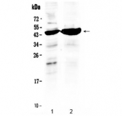Western blot testing of human 1) HeLa and 2) MCF7 cell lysate with TFPI antibody at 0.5ug/ml. Predicted molecular weight ~35 kDa but rountinely observed at 40-50 kDa.