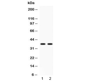 Western blot testing of human 1) HeLa and 2) A549 cell lysate with Annexin VIII antibody at 0.5ug/ml. Predicted molecular weight ~37 kDa.~